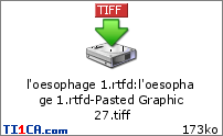 l'oesophage 1.rtfd : l'oesophage 1.rtfd-Pasted Graphic 27.tiff