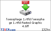 l'oesophage 1.rtfd : l'oesophage 1.rtfd-Pasted Graphic 4.tiff