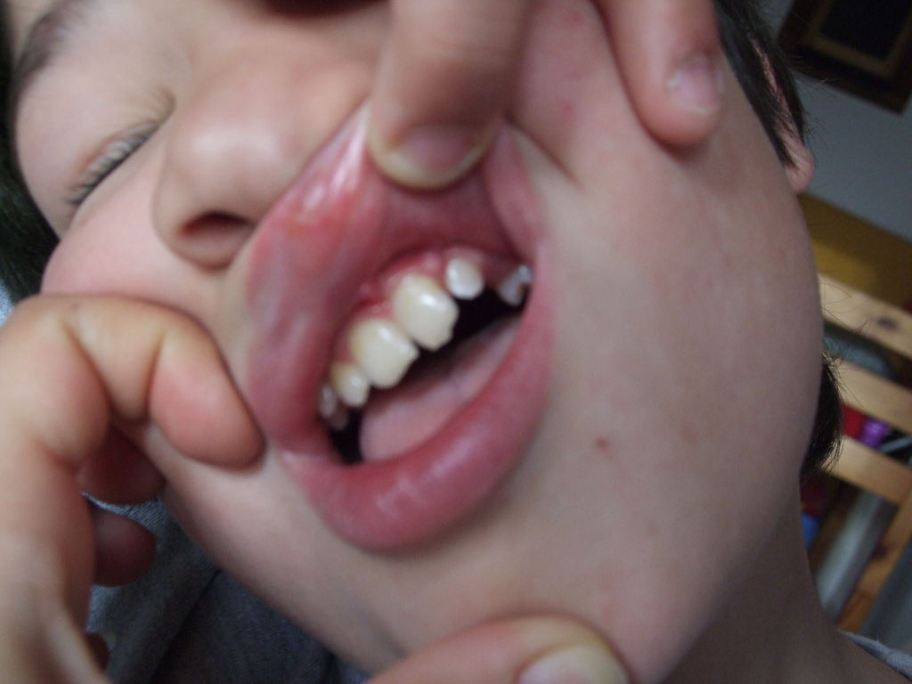 dents th&eacute;o : photo dents 002.jpg