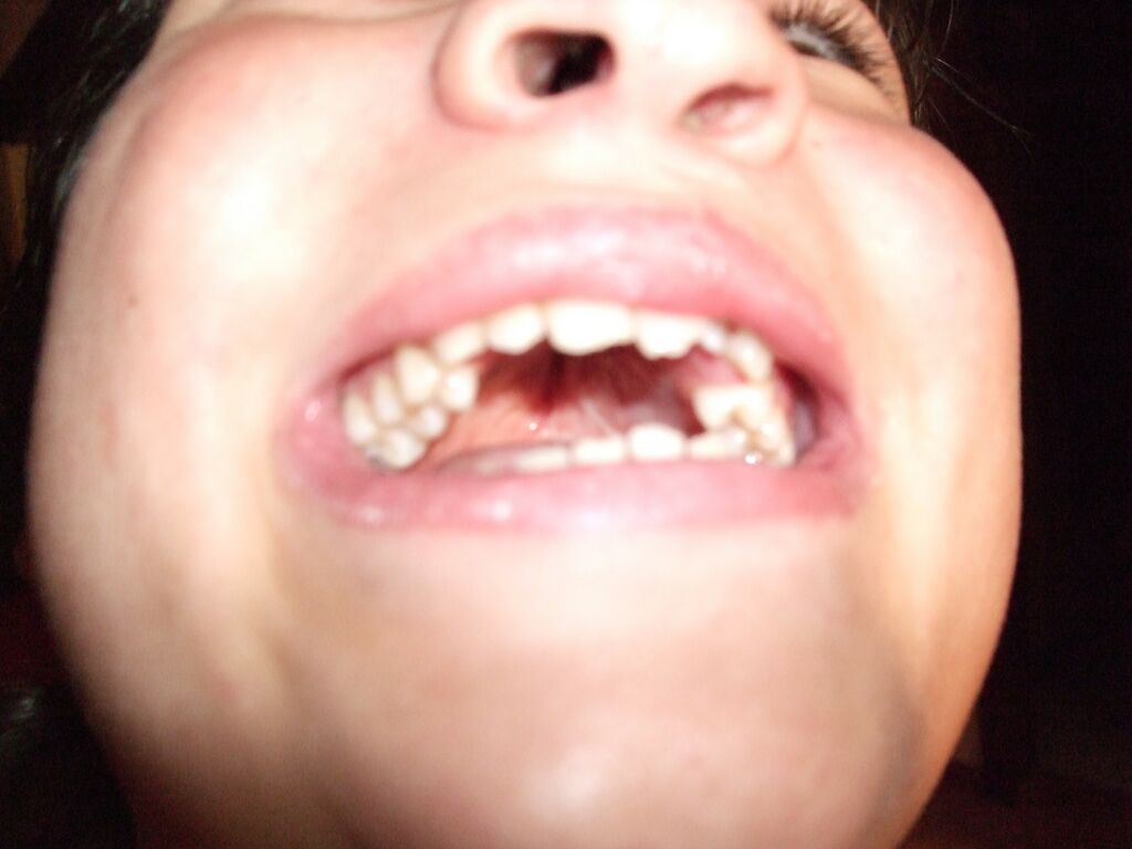 dents 2008 : dents 2008.jpg