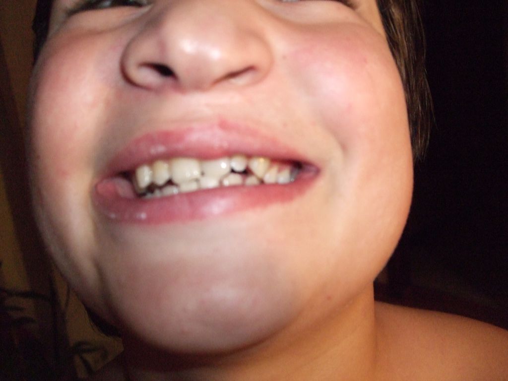 dents Théo 2008 : dents Théo 2008.jpg
